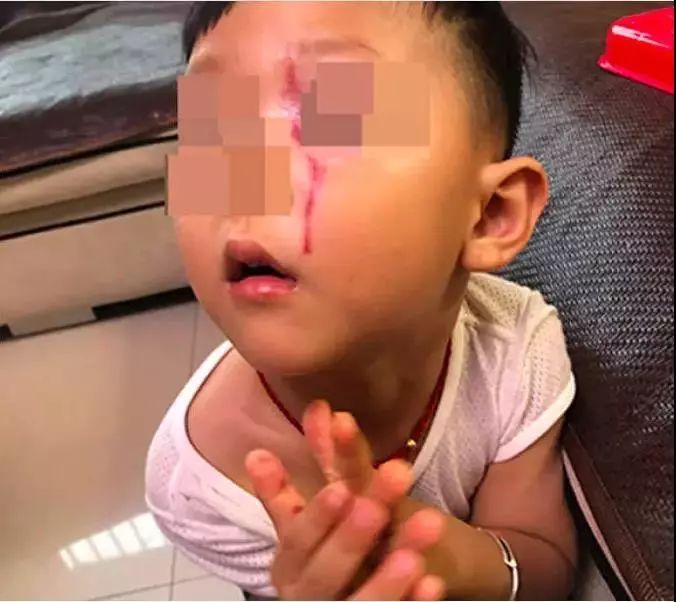 江苏女子给狗狗喂食物被咬,江苏女子被咬狗狗后续