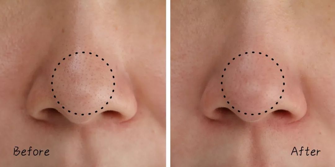 不做清洁面膜护肤品能吸收吗,不做清洁补水有效果吗