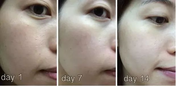 黑科技一秒祛斑,黑科技美白真的有效吗