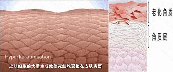 脸上搓出3斤泥！难怪又黄又暗又黑头！10秒给脸蛋“剥壳”，厉害