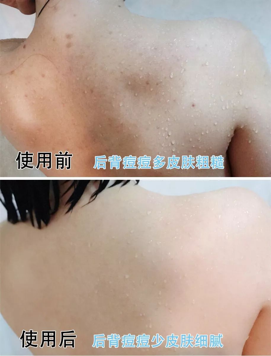 团购|搓背再也不求人！风靡日本的弧形浴刷，轻轻一搓10年污垢刷出来