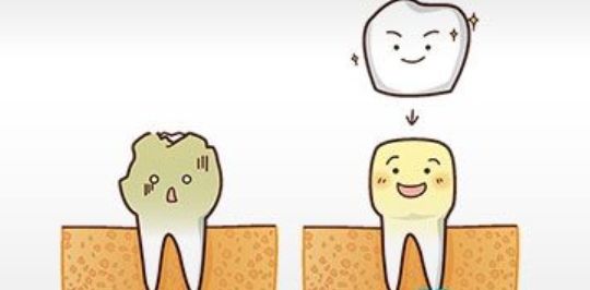 根管治疗后还要做牙套？