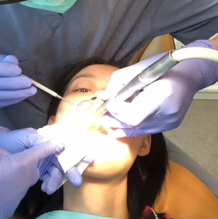 大龄整牙,错过生长发育期怎么办