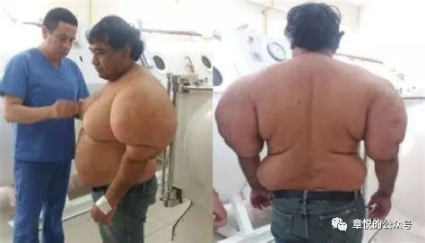 常见潜水疾病,潜水多深才会得潜水病