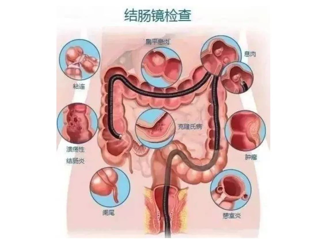 不是癌症的恶性肿瘤有哪些,不是癌症的绝症有哪些