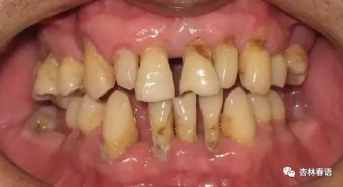 牙周知识大全,杏林微科普急救知识