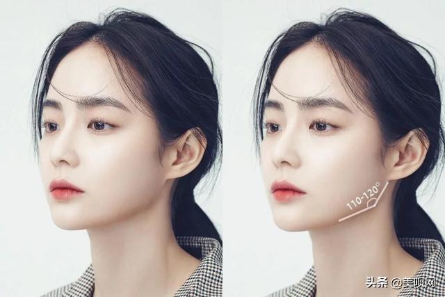 成都医美轮廓固定,成都医美微调面部美学设计