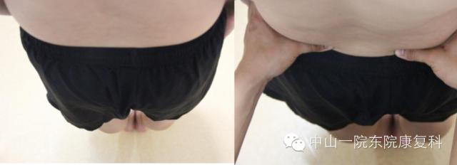 筋膜的康复训练方法,12条筋膜链解析及治疗手法