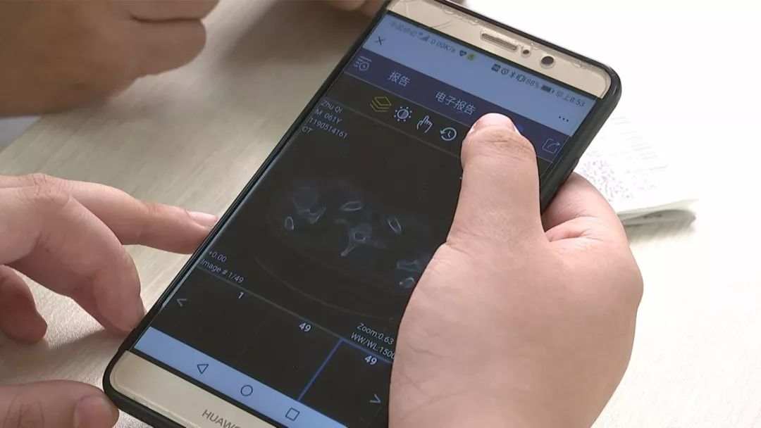 无锡改革开放的巨变,无锡医保改革前后对比