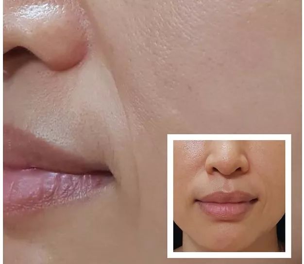 法令纹又黑又长,法令纹又深又长好吗