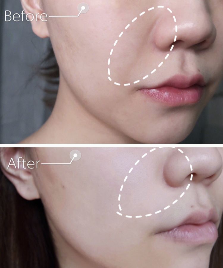 法令纹又黑又长,法令纹又深又长好吗