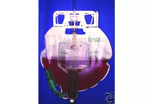 尿液各种颜色都代表什么病,尿液是五颜六色的怎么回事