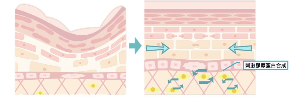 4成抗衰老眼霜抗衰老功效并不显著,同样功效的眼霜价格竟相差7倍?小鱼抗衰老眼霜绿鱼榜单为你揭晓