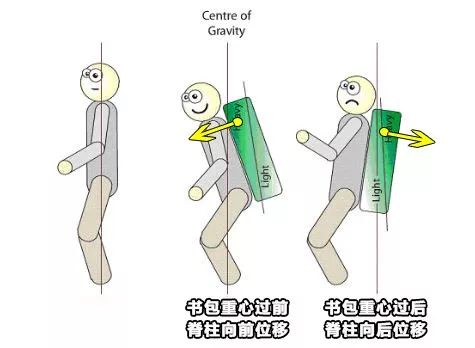 背书包驼背怎么纠正,小孩背书包导致驼背怎么矫正