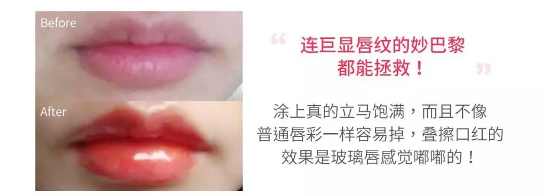 薄唇如何丰唇好看,丰唇使嘴唇变得更美