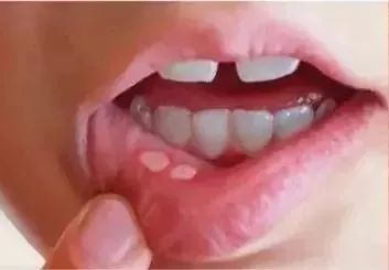 维c美白提亮推荐,抗皱维c