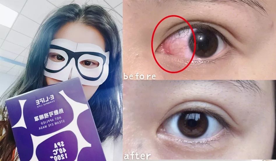 适合熬夜的护眼神器,眼睛疲劳用什么护眼神器