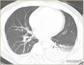 杞皑閰堕珮浼存湁鍙戠儳澶寸柤,澶寸棝楂樼儹