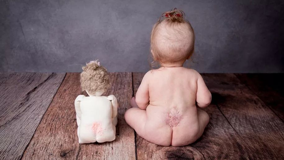 父亲精子正常会不会遗传给儿子,父亲的精子质量会遗传吗