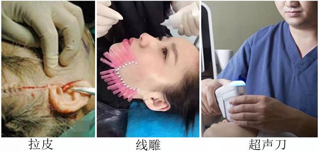 蛋白贴去皱,胶原蛋白颈纹贴