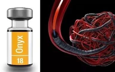 慢性硬膜下血肿会复发吗,慢性硬膜下血肿为什么容易复发