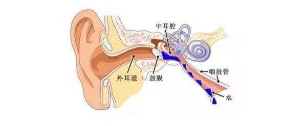 宝宝感冒引起的中耳炎一直耳朵疼,儿童急性中耳炎耳朵疼需要打针吗