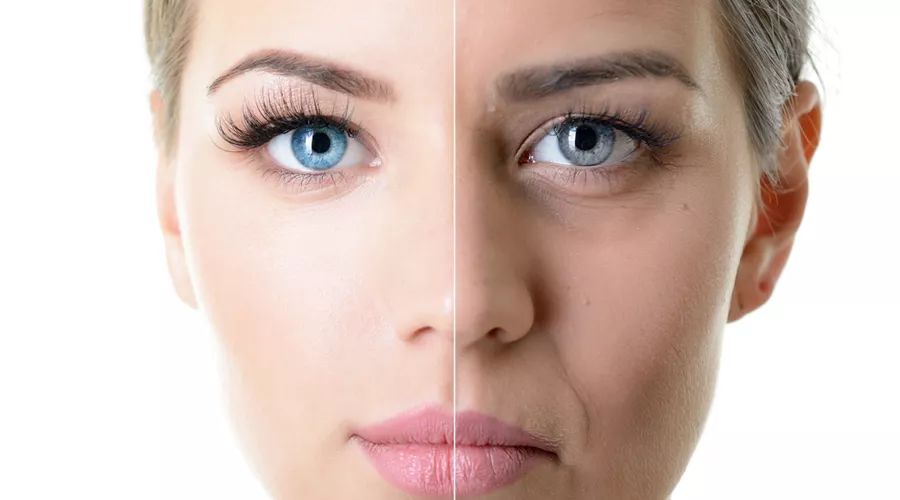 因为它，很多女孩子都不敢轻易笑了