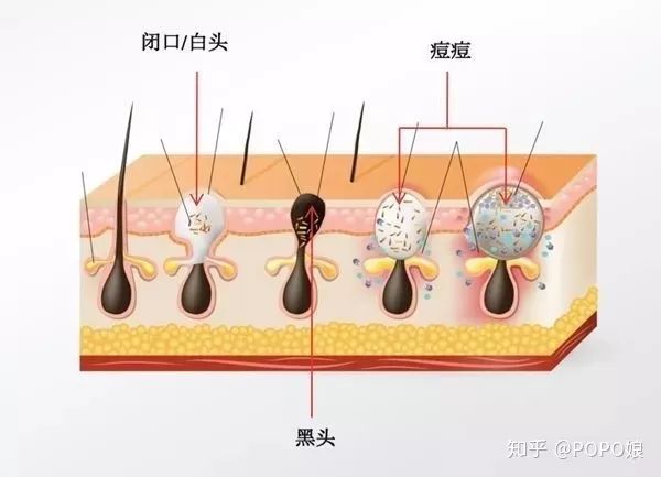 护肤八大误区之皮肤出油,护肤界的迷惑解密