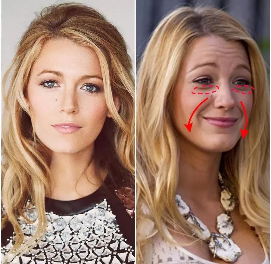 法令纹眼纹一个都逃不掉,法令纹和眼纹怎么才能有效改善