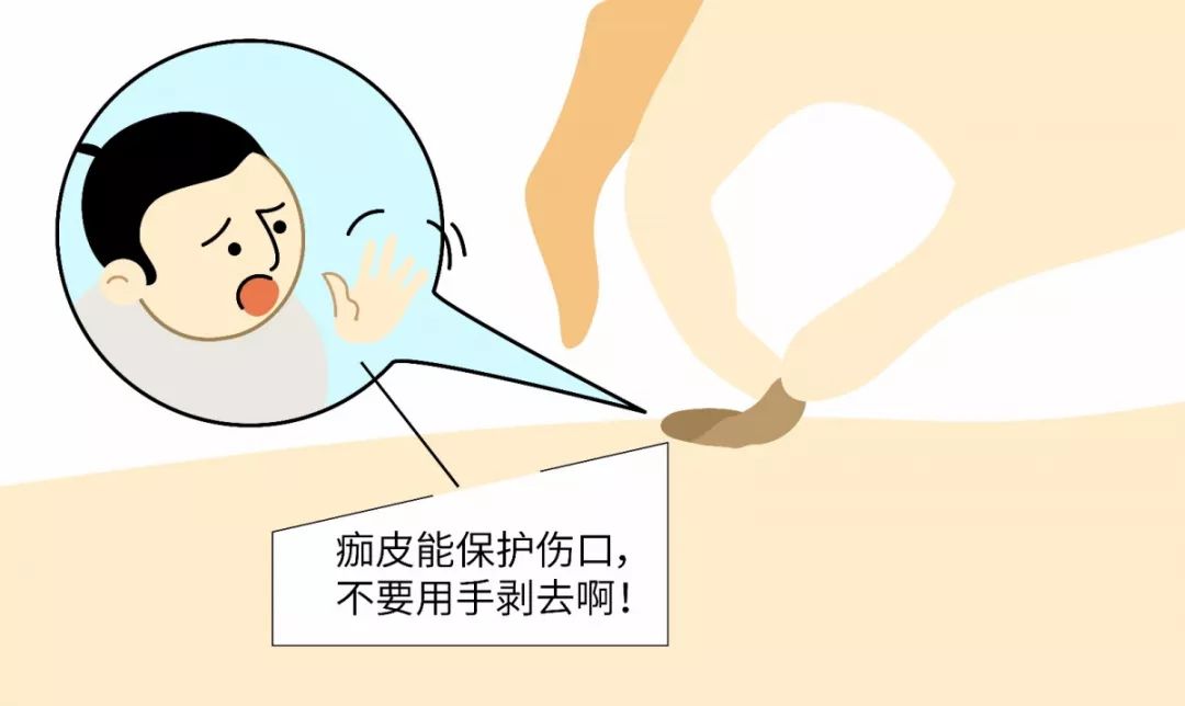 【名医】“我”是万人厌的伤疤，这篇微信教你怎样处理“我”