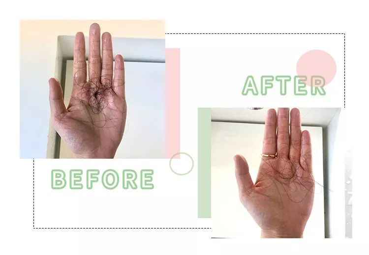 比胖更可怕的竟然是秃头！看完不敢减肥了