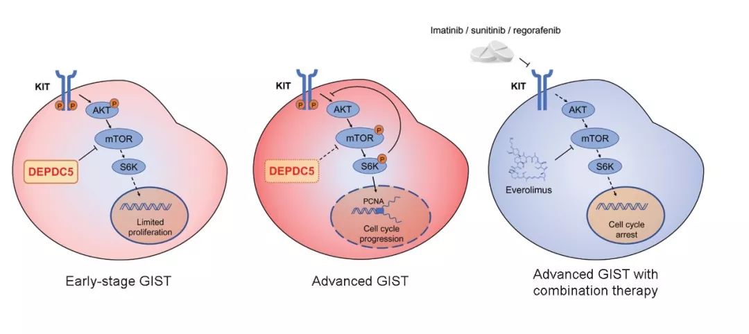科研人员发现胃肠道间质瘤恶性进展新机制