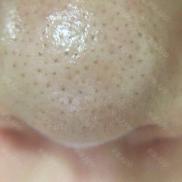 1元体验“爱马仕”级的变美服务，限量100份，再不抢就没了