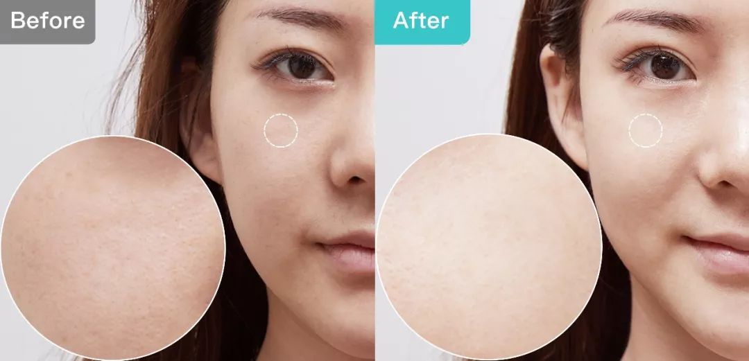 1元体验“爱马仕”级的变美服务，限量100份，再不抢就没了