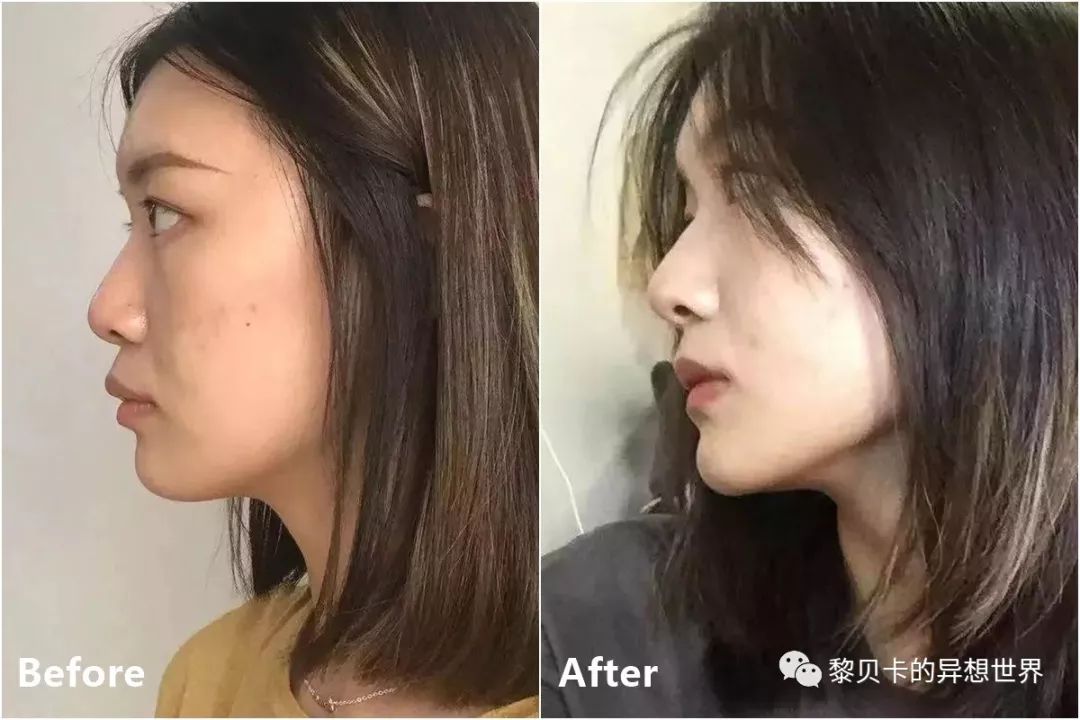 最短只要一年，这件事做对了堪比整容