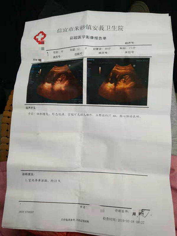 茂名警方侦查“12岁智障女孩再遭性侵”，16日做人流手术