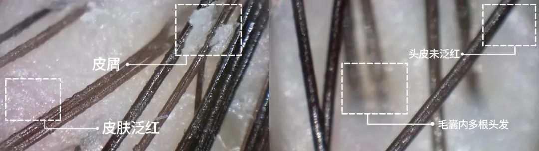 这个拯救颜值的科技产品，居然是一次错误的实验结果？