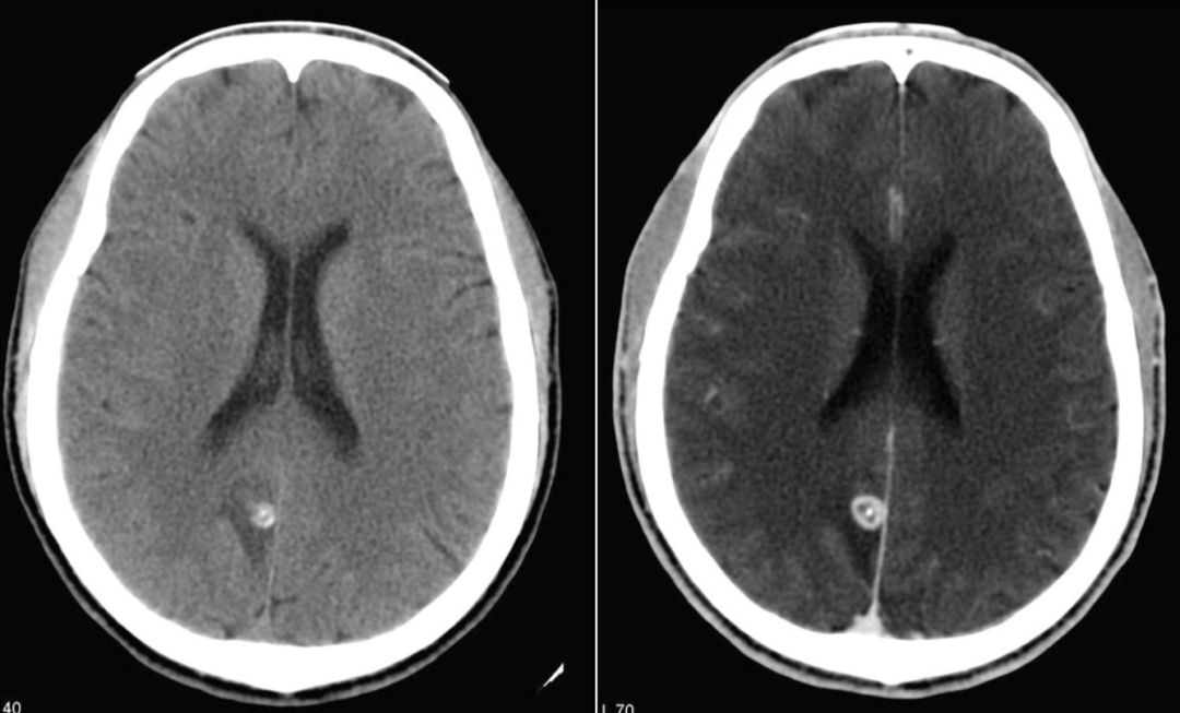 神经影像,神经影像解剖图