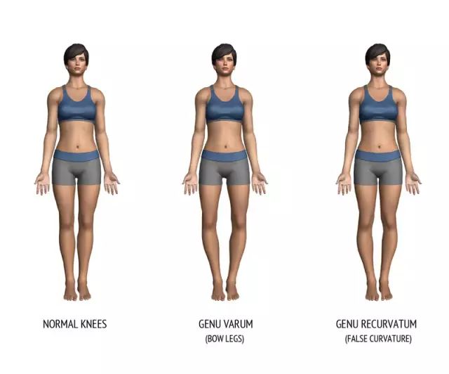 又黑又粗的腿如何拯救,腿型不完美穿上就变细长直