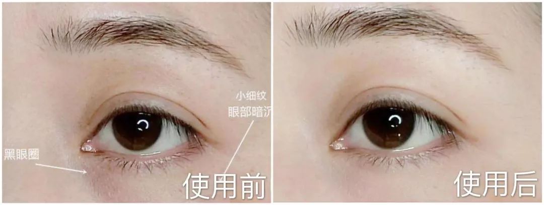 资生堂抗皱,资生堂紧致抗氧化