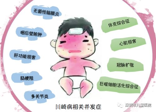 医生说小感冒要重视,本以为是普通感冒结果差点没命