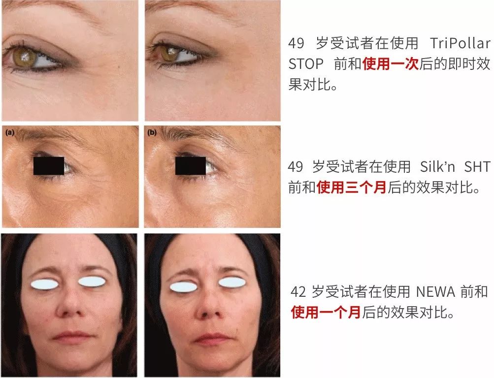 今年最火的美容仪,2023年最火的美容仪器有哪些