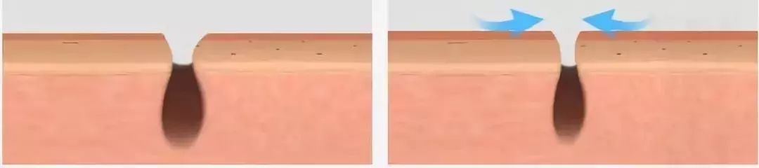 脸上搓出3斤泥！难怪又黄又暗又黑头！10秒给脸蛋“剥壳”，厉害