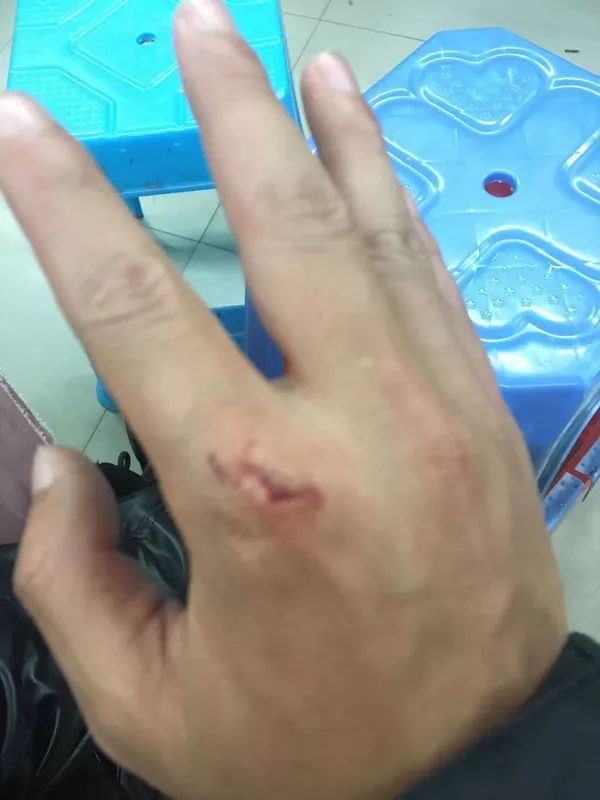 外卖小哥打电话报警怎么处理,外卖小哥接到报警订单