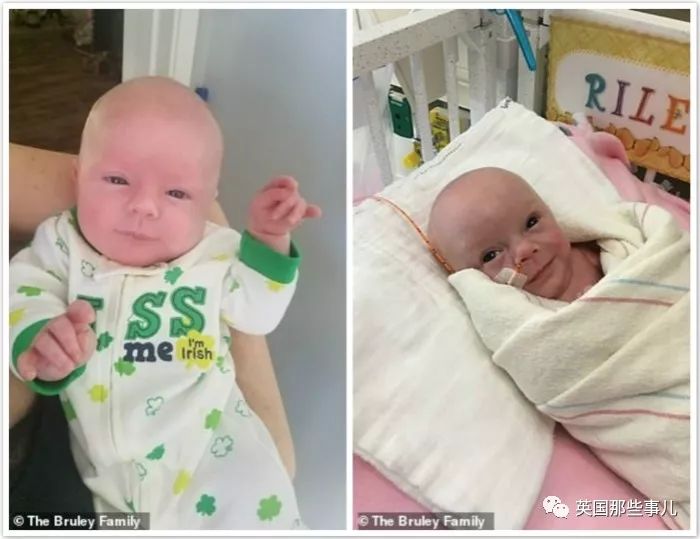 同卵双胞胎体重相差0.8斤正常吗,同卵双胞胎一个胖一个瘦