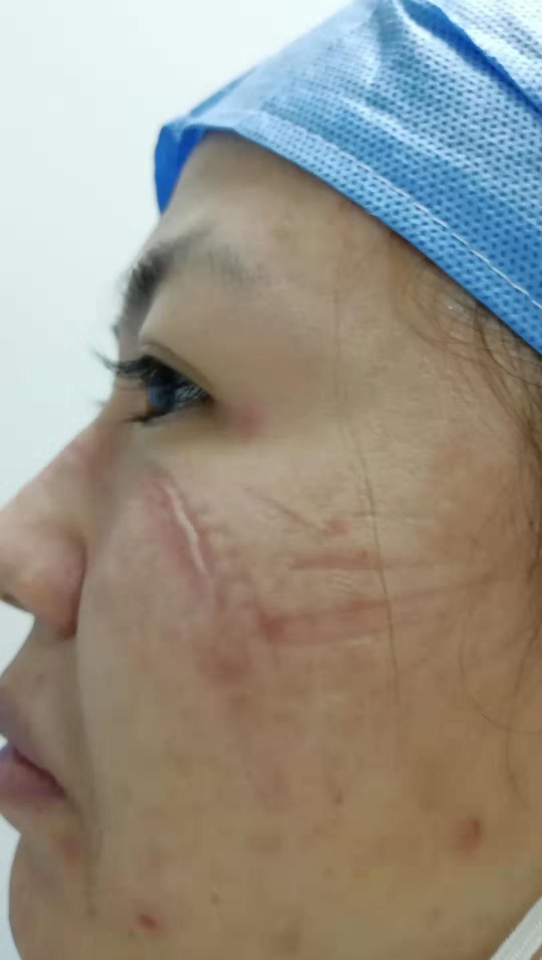 鍚屼粊鍖婚櫌浜﹀簞闄㈠尯鍙戠儹闂ㄨ瘖,鍚屼粊鍖婚櫌浜﹀簞鍙戠儹闂ㄨ瘖娴佺▼