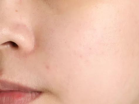 洗劫了编辑部后才发现，她们的面膜都这么好用