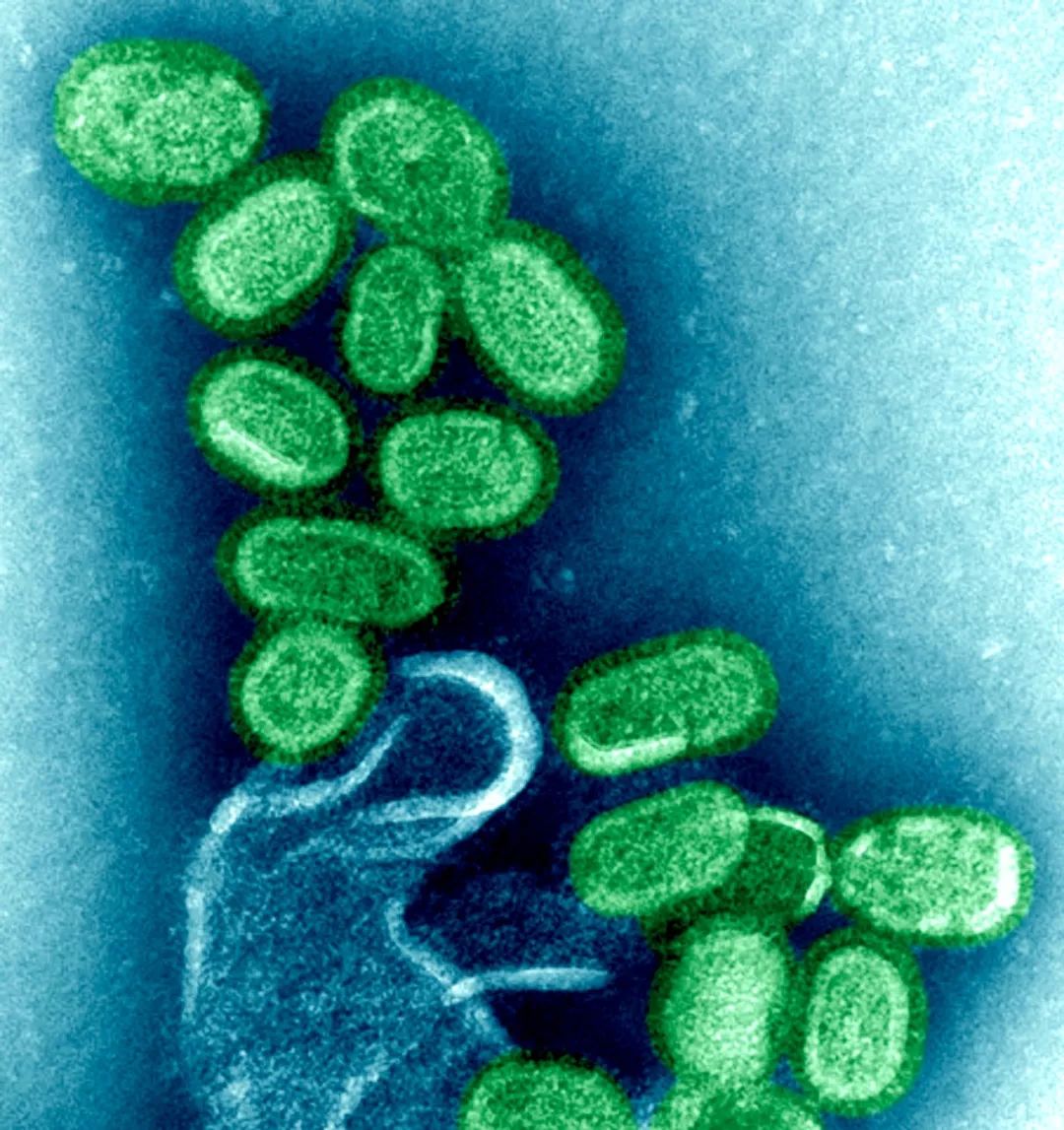 鍋囧鐥呮瘨鎰熸煋浜嗕綘,鍋囧鐥呮瘨鎰熸煋浜嗘垜