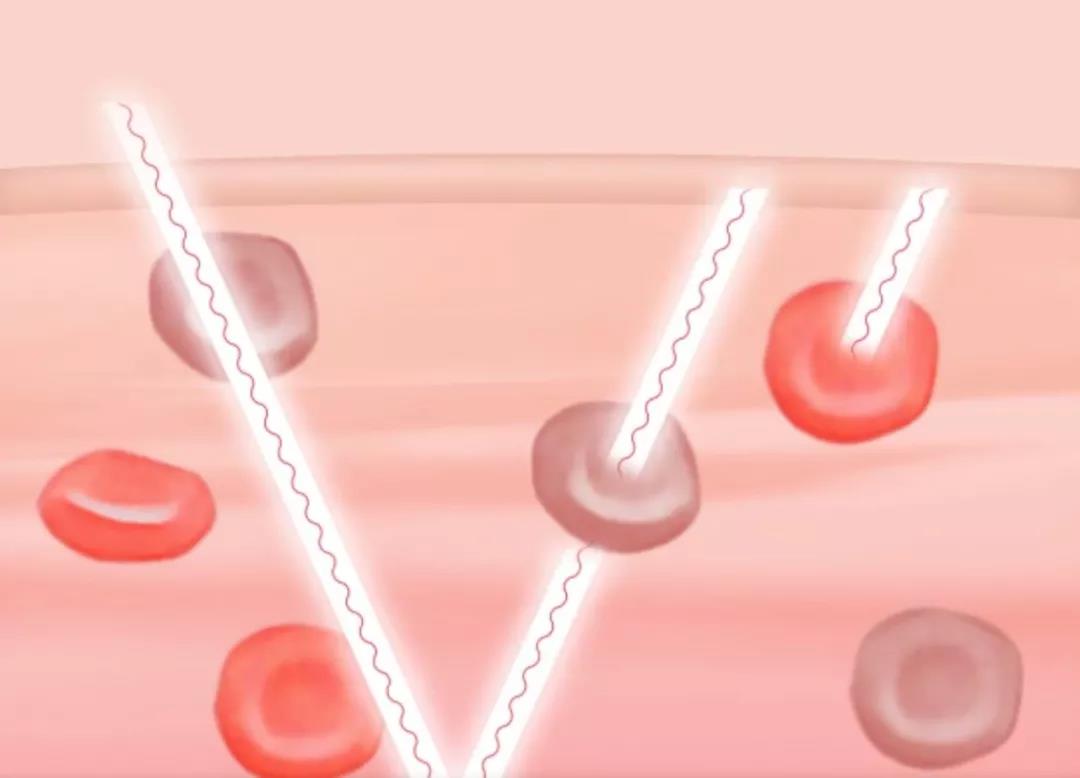 运动手表测血氧测评,运动手表怎么看血氧