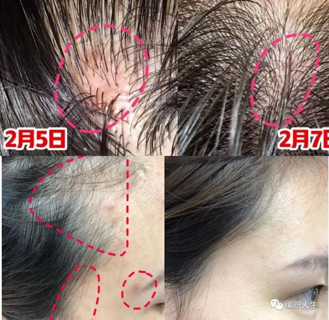 德国老太太用什么洗发水,93岁德国老太太